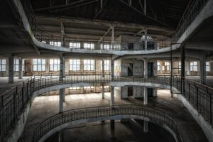 デリケートゾーンの黒ずみが急に濃くなった原因と対策は？